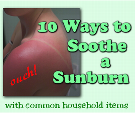 10 Ways to Soothe a Sunburn